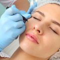 Different Types of Facial Cosmetic Surgery