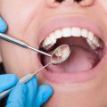 4 Reasons Why Consistent Dental Care Matters