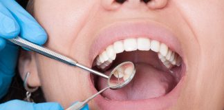 4 Reasons Why Consistent Dental Care Matters